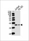 TYSY Antibody (C-term)